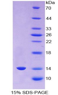 Recombinant Angiogenic Factor With G Patch And FHA Domains 1 (AGGF1)