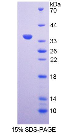 Recombinant Angiogenic Factor With G Patch And FHA Domains 1 (AGGF1)