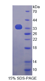 Recombinant Adaptor Protein Phosphotyrosine Interaction PH Domain And leucine Zipper Containing Protein 1 (APPL1)