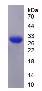 Recombinant AXL Receptor Tyrosine Kinase (AXL)
