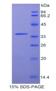 Recombinant Alpha-2-Glycoprotein 1, Zinc Binding (aZGP1)