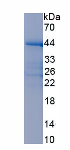 Recombinant Calcium/Calmodulin Dependent Protein Kinase Kinase 2 (CAMKK2)