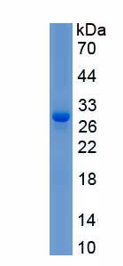 Recombinant Cell Death Inducing DFFA Like Effector A (CIDEA)