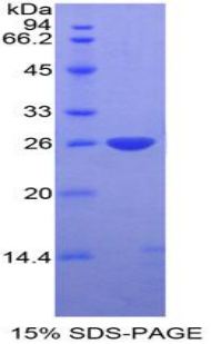 Recombinant DIX Domain Containing Protein 1 (DIXDC1)