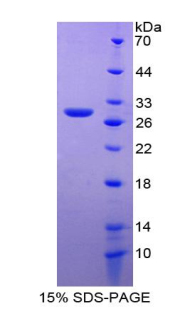 Recombinant Delta Like 1 Homolog (dLK1)