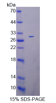 Recombinant Deltex Homolog 1 (DTX1)