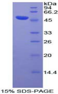 Recombinant Dishevelled, Dsh Homolog 3 (DVL3)