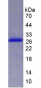 Recombinant Dishevelled, Dsh Homolog 2 (DVL2)