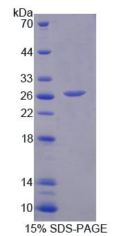Recombinant Family With Sequence Similarity 3, Member B (FAM3B)