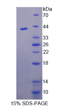 Recombinant FK506 Binding Protein Like Protein (FKBPL)