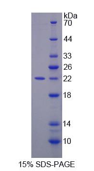 Recombinant Growth Arrest And DNA Damage Inducible Protein Alpha (GADD45a)