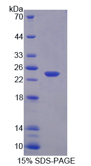Recombinant Growth Arrest And DNA Damage Inducible Protein Gamma (GADD45g)