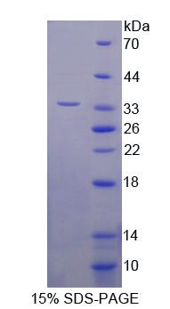Recombinant Hermansky Pudlak Syndrome Protein 1 (HPS1)