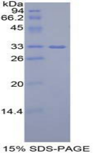 Recombinant Insulin Like Growth Factor 2 mRNA Binding Protein 2 (IGF2BP2)