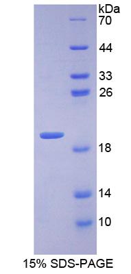 Recombinant Inositol Polyphosphate-4-Phosphatase Type I 107kDa (INPP4A)