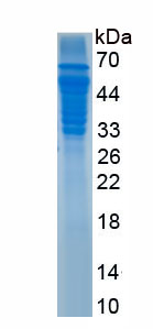 Recombinant Jagged 2 Protein (JAG2)