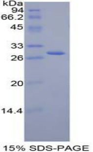 Recombinant Jagged 2 Protein (JAG2)