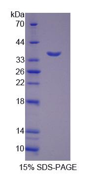 Recombinant Kazal Type Serine Protease Inhibitor Domain Containing Protein 1 (KAZALD1)