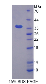 Recombinant KH Domain Containing, RNA Binding, Signal Transduction Associated Protein 1 (KHDRBS1)