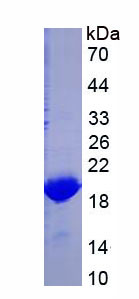 Recombinant Microtubule Associated Protein 1 Light Chain 3 Beta (MAP1LC3b)