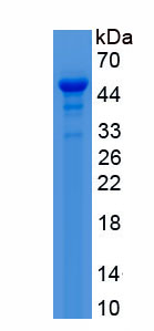 Recombinant Myeloid/Lymphoid Or Mixed Lineage Leukemia 2 (MLL2)