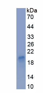Recombinant V-Myc Myelocytomatosis Viral Oncogene Homolog 1, Lung Carcinoma Derived (MYCL1)