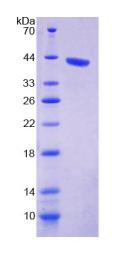 Recombinant Kidney And Brain Protein (KIBRA)