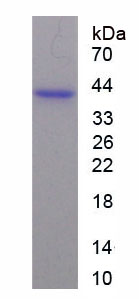 Recombinant Otubain 1 (OTUB1)