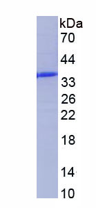 Recombinant Otubain 1 (OTUB1)