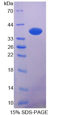 Recombinant N-myc Downstream Regulated Gene 2 (NDRG2)