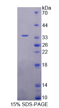 Recombinant Nei Endonuclease VIII Like Protein 1 (NEIL1)