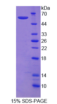 Recombinant Semaphorin 3E (SEMA3E)