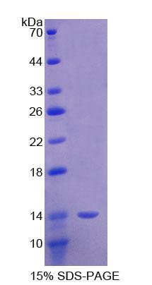 Recombinant Semaphorin 3E (SEMA3E)