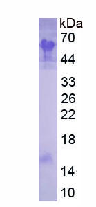 Recombinant Semaphorin 5B (SEMA5B)