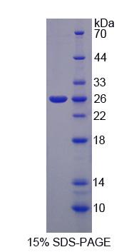 Recombinant Nuclear Factor Of Activated T-Cells, Cytoplasmic 2 (NFATC2)