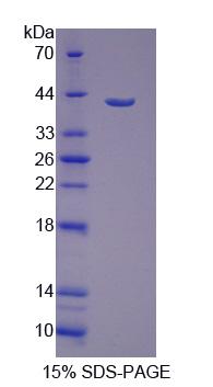 Recombinant PDZ And LIM Domain Protein 1 (PDLIM1)