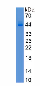 Recombinant Protein Kinase, cAMP Dependent Catalytic Alpha (PRKACa)