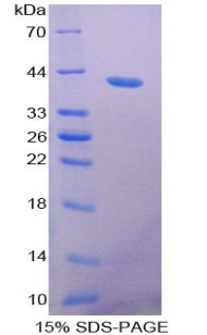 Recombinant Resistin Like Beta (RETNLb)