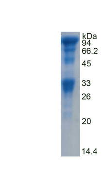 Recombinant Roundabout, Axon Guidance Receptor, Homolog 1 (ROBO1)