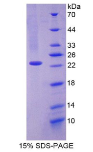 Recombinant CD27 Binding Protein (CD27BP)