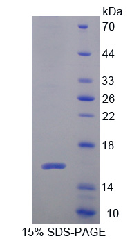 Recombinant Cytospin B (CYTSB)