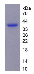 Recombinant T-Cell, Immune Regulator 1 (TCIRG1)