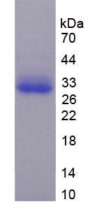 Recombinant TNFRSF1A Associated Via Death Domain Protein (TRADD)