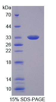 Recombinant Tumor Necrosis Factor Alpha Induced Protein 6 (TNFaIP6)