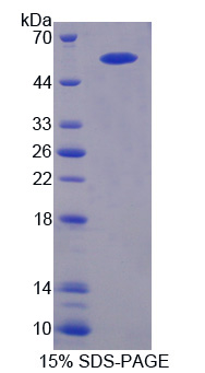 Recombinant Amyloid Beta Precursor Protein Binding B1 Interacting Protein (APBB1IP)