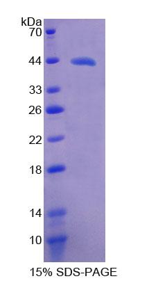 Recombinant Phospholipase A2, Group IVD (PLA2G4D)