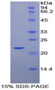 Recombinant POTE Ankyrin Domain Family, Member G (POTEG)