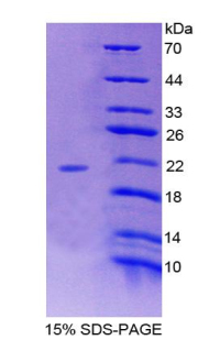 Recombinant POTE Ankyrin Domain Family, Member G (POTEG)