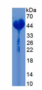 Recombinant SET Domain Containing Protein 7 (SETD7)