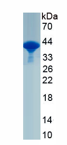 Recombinant Stimulated By Retinoic Acid Gene 8 (STRA8)